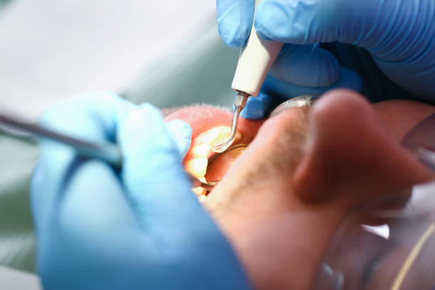 Professional Emergency Dentist in AL