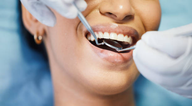 Best Emergency Gum Treatment in Anniston, AL