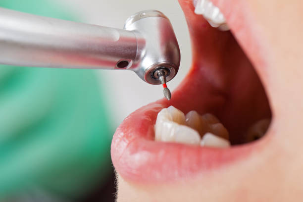 Best Cosmetic Emergency Dentistry in Anniston, AL